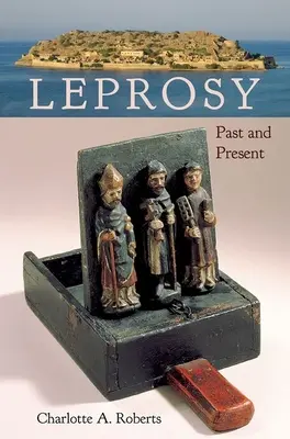 Malomocenstvo: minulosť a súčasnosť - Leprosy: Past and Present