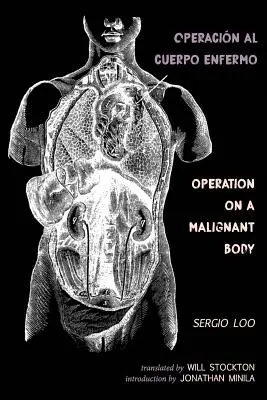 Operacin al Cuerpo Enfermo / Operácia na zhubnom tele - Operacin al Cuerpo Enfermo / Operation on a Malignant Body