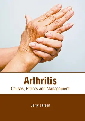 Artritída: Príčiny, následky a liečba - Arthritis: Causes, Effects and Management