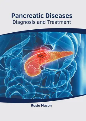 Choroby slinivky brušnej: Pankreasu a pankreatických žliaz: diagnostika a liečba - Pancreatic Diseases: Diagnosis and Treatment