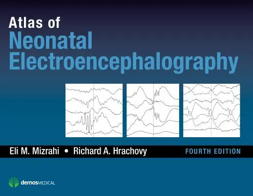 Atlas novorodeneckej elektroencefalografie - Atlas of Neonatal Electroencephalography