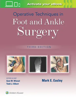 Operačné techniky v chirurgii nohy a členku - Operative Techniques in Foot and Ankle Surgery