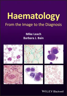 Hematológia: Od obrazu k diagnóze - Haematology: From the Image to the Diagnosis