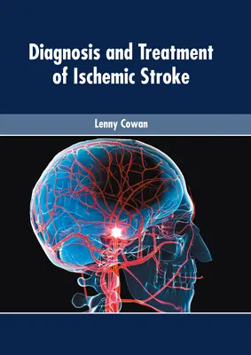 Diagnostika a liečba ischemickej mozgovej príhody - Diagnosis and Treatment of Ischemic Stroke