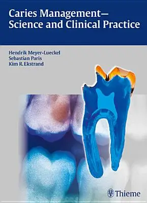 Liečba zubného kazu - veda a klinická prax - Caries Management - Science and Clinical Practice