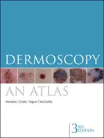 Dermoskopia: Atlas - Dermoscopy: An Atlas