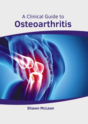 Klinický sprievodca osteoartrózou - A Clinical Guide to Osteoarthritis