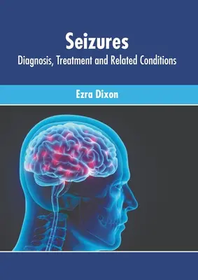 Záchvaty: Diagnóza, liečba a súvisiace stavy - Seizures: Diagnosis, Treatment and Related Conditions