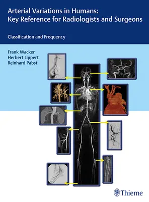 Arteriálne zmeny u ľudí: Kľúčová príručka pre rádiológov a chirurgov: Klasifikácie a frekvencia - Arterial Variations in Humans: Key Reference for Radiologists and Surgeons: Classifications and Frequency
