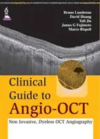 Klinický sprievodca angio-OCT: neinvazívna OCT angiografia bez použitia farbiva - Clinical Guide to Angio-OCT: Non Invasive, Dyeless OCT Angiography