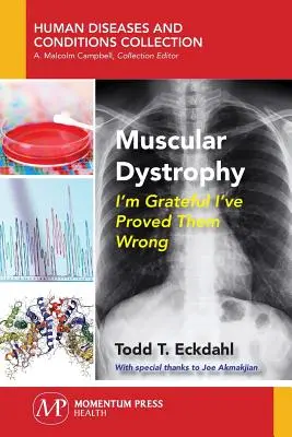 Svalová dystrofia: Som vďačná, že som im dokázala, že sa mýlia - Muscular Dystrophy: I'm Grateful I've Proved Them Wrong