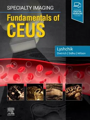 Špeciálne zobrazovanie: Základy ceus - Specialty Imaging: Fundamentals of Ceus
