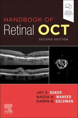 Optická koherentná tomografia - Handbook of Retinal Oct: Optical Coherence Tomography