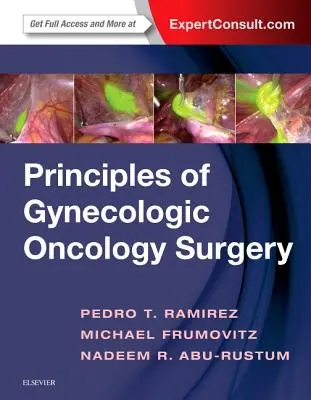 Princípy gynekologickej onkologickej chirurgie - Principles of Gynecologic Oncology Surgery
