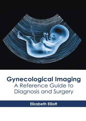 Gynekologické zobrazovanie: Príručka pre diagnostiku a chirurgiu - Gynecological Imaging: A Reference Guide to Diagnosis and Surgery