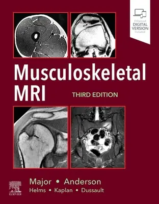MRI pohybového aparátu - Musculoskeletal MRI
