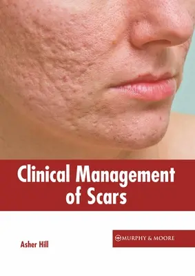 Klinický manažment jaziev - Clinical Management of Scars