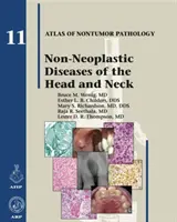 Neoplastické ochorenia hlavy a krku - Non-Neoplastic Diseases of the Head and Neck