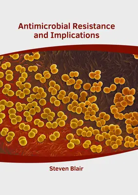 Antimikrobiálna rezistencia a jej dôsledky - Antimicrobial Resistance and Implications