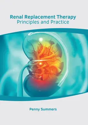 Renálna substitučná terapia: Princípy a prax - Renal Replacement Therapy: Principles and Practice