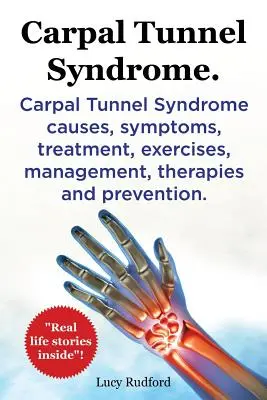 Syndróm karpálneho tunela. Syndróm karpálneho tunela príčiny, príznaky, liečba, cvičenia, manažment, terapie a prevencia. Skutočné príbehy zo života vo vnútri! - Carpal Tunnel Syndrome. Carpal Tunnel Syndrome causes, symptoms, treatment, exercises, management, therapies and prevention. Real Life Stories Inside!