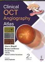 Klinická angiografia OCT Atlas - Clinical OCT Angiography Atlas