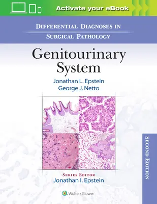 Diferenciálna diagnostika v chirurgickej patológii: Genitourinárny systém - Differential Diagnoses in Surgical Pathology: Genitourinary System