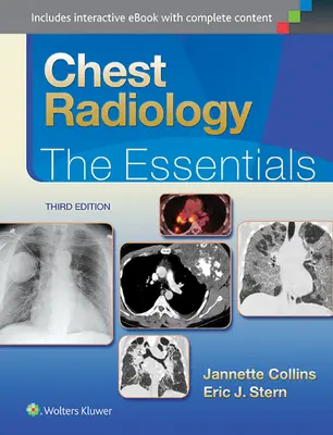 Rádiológia hrudníka: Základné informácie - Chest Radiology: The Essentials