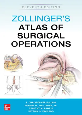 Zollingerov atlas chirurgických operácií, jedenáste vydanie - Zollinger's Atlas of Surgical Operations, Eleventh Edition