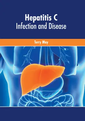 Hepatitída C: Infekcia a choroba - Hepatitis C: Infection and Disease