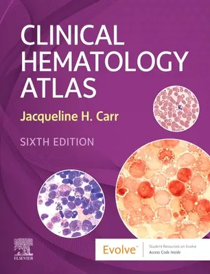 Atlas klinickej hematológie (Carr Jacqueline H. (vedúca laboratória Oddelenie patológie a laboratórnej medicíny Clarian Health Indianapolis IN)) - Clinical Hematology Atlas (Carr Jacqueline H. (Laboratory Manager Department of Pathology and Laboratory Medicine Clarian Health Indianapolis IN))