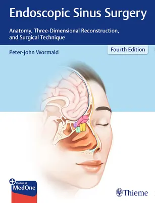 Endoskopická chirurgia prínosových dutín: Anatómia, trojrozmerná rekonštrukcia a chirurgická technika - Endoscopic Sinus Surgery: Anatomy, Three-Dimensional Reconstruction, and Surgical Technique