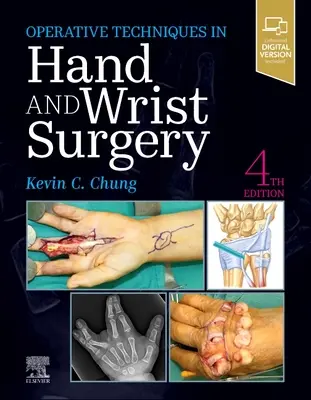 Operačné techniky: Chirurgia ruky a zápästia - Operative Techniques: Hand and Wrist Surgery