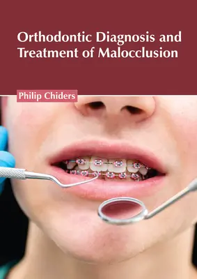Ortodontická diagnostika a liečba maloklúzie - Orthodontic Diagnosis and Treatment of Malocclusion