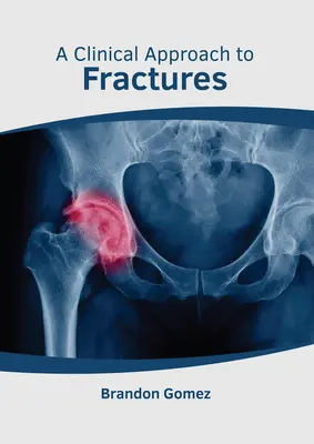 Klinický prístup k zlomeninám - A Clinical Approach to Fractures