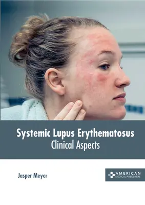 Systémový lupus erythematosus: Klinické aspekty - Systemic Lupus Erythematosus: Clinical Aspects