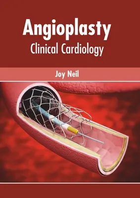Angioplastika: Klinická kardiológia - Angioplasty: Clinical Cardiology