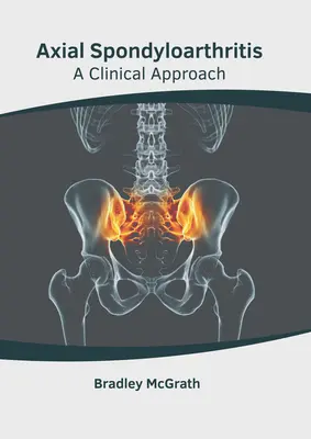 Axiálna spondyloartritída: Klinický prístup - Axial Spondyloarthritis: A Clinical Approach