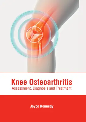 Osteoartróza kolena: Vydanie knihy: Posúdenie, diagnostika a liečba - Knee Osteoarthritis: Assessment, Diagnosis and Treatment