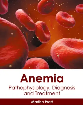 Anémia: Patofyziológia, diagnostika a liečba - Anemia: Pathophysiology, Diagnosis and Treatment
