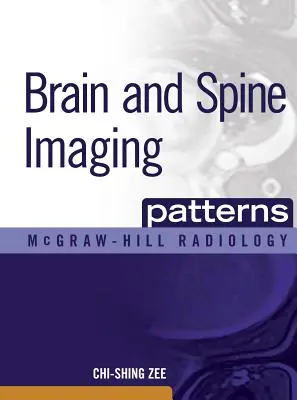 Zobrazovacie vzory mozgu a chrbtice: Zobrazovanie mozgu a chrbtice - Brain and Spine Imaging Patterns: Brain & Spine Imaging