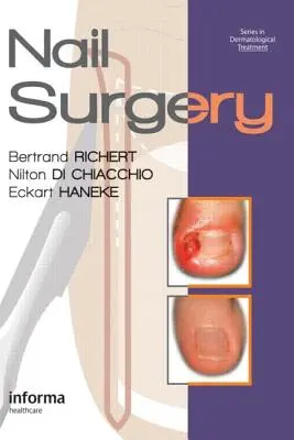 Chirurgia nechtov - Nail Surgery