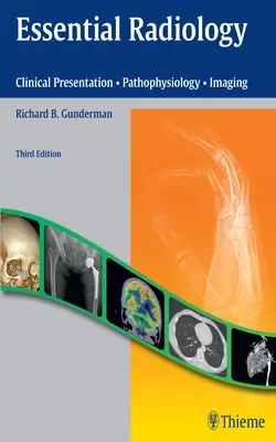 Základná rádiológia: Klinická prezentácia - Patofyziológia - Zobrazovanie - Essential Radiology: Clinical Presentation - Pathophysiology - Imaging