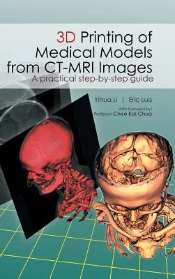 3D tlač lekárskych modelov zo snímok CT-MRI: Praktický sprievodca krok za krokom - 3D Printing of Medical Models from CT-MRI Images: A Practical step-by-step guide