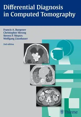 Diferenciálna diagnostika v počítačovej tomografii - Differential Diagnosis in Computed Tomography