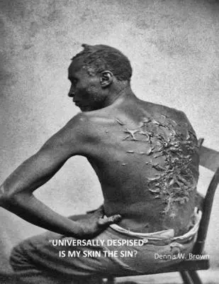 Všeobecne opovrhovaná je moja koža hriechom? - Universally Despised Is My Skin the Sin?
