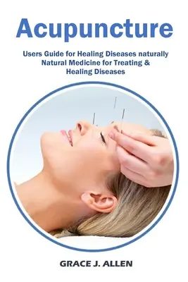 Akupunktúra: Akupunktúra: Príručka pre užívateľov na liečenie chorôb prirodzená prírodná medicína na liečbu a liečenie chorôb - Acupuncture: Users Guide for Healing Diseases naturally Natural Medicine for Treating & Healing Diseases