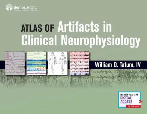 Atlas artefaktov v klinickej neurofyziológii - Atlas of Artifacts in Clinical Neurophysiology