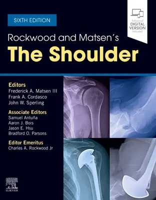 Rockwood a Matsenovo rameno - Rockwood and Matsen's the Shoulder