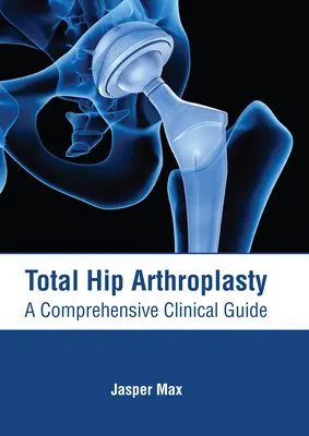 Totálna artroplastika bedrového kĺbu: (A Comprehensive Clinical Guide) - Total Hip Arthroplasty: A Comprehensive Clinical Guide